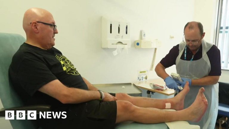Cornwall Sees Fewer Diabetes Amputations as Cases Rise
